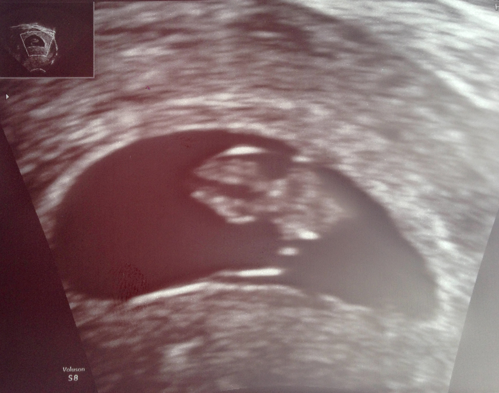 baby-sono-1